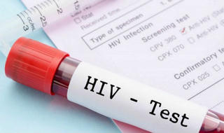 Xét nghiệm HIV sớm - phấn đấu hướng tới mục tiêu 90 - 90 - 90