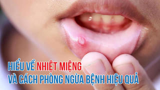 Hiểu về nhiệt miệng và cách phòng ngừa bệnh hiệu quả