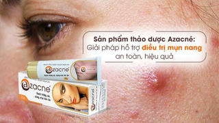 Sản phẩm thảo dược Azacné: Giải pháp hỗ trợ điều trị mụn nang an toàn, hiệu quả