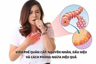Viêm phế quản cấp: Nguyên nhân, dấu hiệu và cách phòng ngừa hiệu quả
