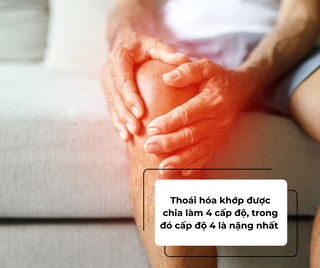 Các cấp độ của thoái hóa khớp gối và cách cải thiện từ CốtWells chứa màng vỏ trứng