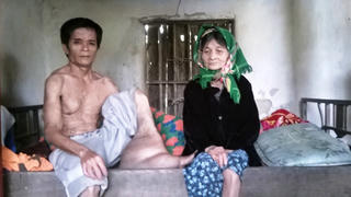 Người đàn ông tắt nắng mới dám ra đường vì mặc cảm xấu xí