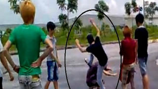 Ông lão mất mạng vì... "ngứa tai"