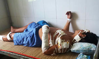 Một người đàn ông bị vợ  chém gục tại chỗ trong cơn ghen