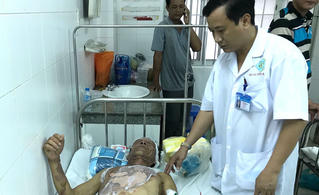 Ăn tiệc cưới, hơn chục nạn nhân bị bỏng 