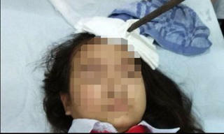  Nam sinh lớp 7 phóng dao cắm vào trán bạn gái cùng lớp