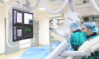 Nút mạch máu, xử lý thành công khối u xơ tử cung