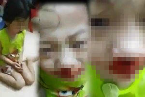 Phẫn nộ: Bé gái mặt dính máu, nghi bị mẹ đánh rồi live stream trên facebook