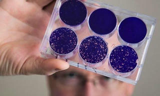 Virus bại liệt được "hồi sinh" để trị ung thư não