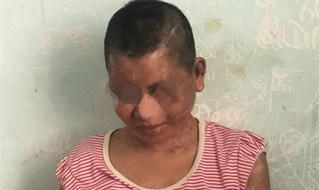 Bộ trưởng Đào Ngọc Dung đề nghị xử lý nghiêm vụ cô gái bị bạo hành ở Gia Lai