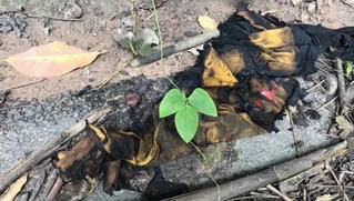 Bé gái 15 tuổi bị bạn trai tạt xăng đốt