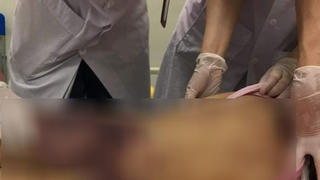 Bé gái 6 tuổi tử vong: Người bố thừa nhận đã đánh con