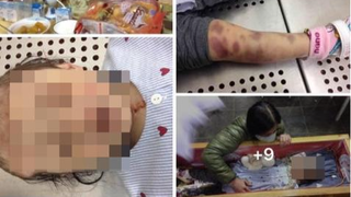 Đau lòng khi trẻ là nơi “trút bức xúc” của người lớn