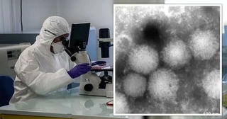 Phát hiện virus chưa từng biết đến, gây bệnh lạ trên người ở Nhật Bản