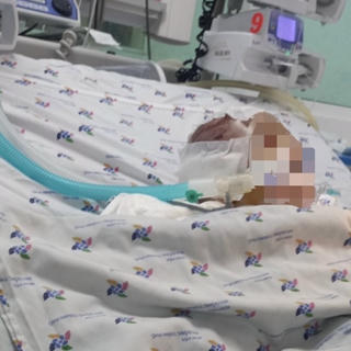 Bé 6 tháng tuổi xuất huyết não nghi bị bạo hành