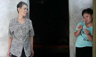 Kỷ niệm 56 năm thảm họa da cam ở Việt Nam (10/8/1961-10/8/2017): Nỗi đau bao giờ kết?