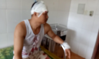 Mua chó Great Dane không thành, kéo đồng bọn đánh suýt chết chủ chó?