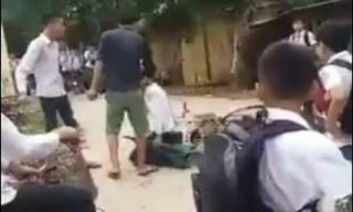 Vừa ra khỏi nhà nam thanh niên bị đánh chấn thương sọ não