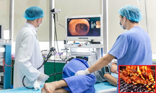 Thói quen ăn uống khiến nhiều người trẻ mắc ung thư