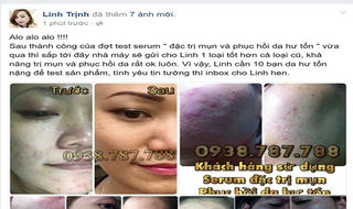 Mỹ phẩm trên mạng xã hội: Hàng "lởm" chui qua lỗ hổng hành lang pháp lý