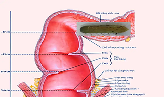Một bác sĩ phải cấp cứu vì lọt cả quả dưa leo vào bụng