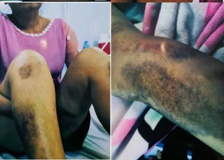 Nạn nhân kêu cứu vì bị hành hung 2 năm nhưng hung thủ vẫn nhởn nhơ ngoài vòng pháp luật