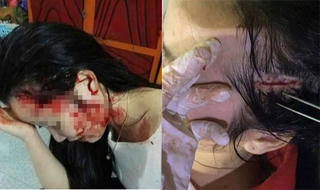 Ban Tuyên giáo Hà Tĩnh chỉ đạo làm rõ vụ “thiếu nữ bị lôi lên taxi hành hung dã man“