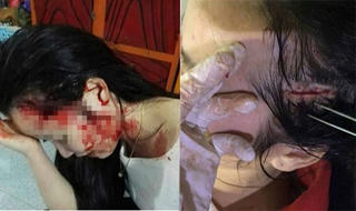 Hà Tĩnh: Vụ thiếu nữ bị hành hung dã man, xử phạt một nữ giáo viên