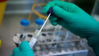 Đầu tư hơn 5 tỉ đồng để lắp đặt hệ thống xét nghiệm Realtime RT-PCR