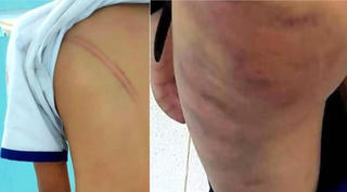 Đánh đập con chồng, dẫn đến 4% thương tật, mẹ kế sẽ phải chịu trách nhiệm thế nào?