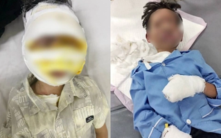 Bản tin tổng hợp 21/03: Máy tính đang sạc phát nổ khiến bé trai bỏng nặng