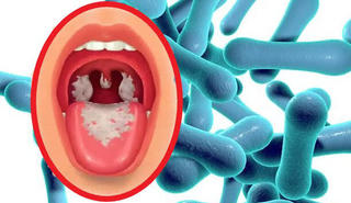 Bệnh bạch hầu lây truyền như thế nào?