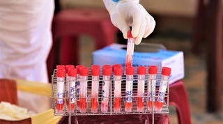 Quảng Ngãi: Đề nghị HĐND tỉnh ban hành Nghị quyết giá dịch vụ xét nghiệm SARS-CoV-2