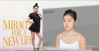Ngàn lẻ một chuyện phẫu thuật thẩm mỹ - Kỳ 14: Đằng sau vẻ đẹp lung linh là nỗi ám ảnh dao kéo