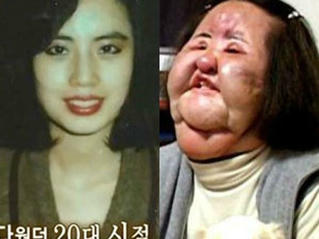Khi cái đẹp phải đánh đổi bằng cả tính mạng