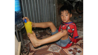 Nghị lực phi thường của cậu bé khuyết tay vẽ cuộc đời bằng đôi chân kỳ diệu