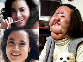 Những ám ảnh ở Hàn Quốc - kinh đô thẩm mỹ thế giới