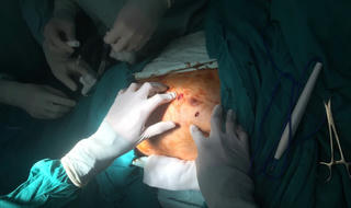 Bệnh nhân đột nhiên lấy kéo đâm thủng tim, phổi của mình