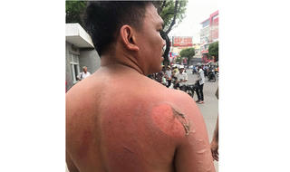 Dùng dầu sôi, gậy ba khúc gây thương tích người thi hành công vụ