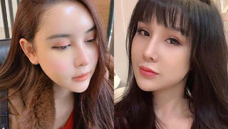 Trào lưu 'dao kéo' biến hình 'sao' Việt thế nào?