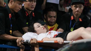 Nữ cổ động viên trọng thương vì pháo sáng, Công an 'vào cuộc' điều tra 