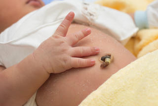 Cách nhận biết dấu hiệu nguy hiểm trên rốn trẻ sơ sinh