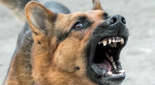 Cháu bé 3 tuổi bị chó nhà cắn trọng thương vùng mặt