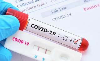 Sau khi tiếp xúc F0, cần bao lâu thì test mới có kết quả chính xác?