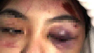 Nữ sinh mặc đồng phục bị đánh hội đồng dã man, phải nhập viện cấp cứu