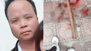 Người đàn ông Hà Nội bị đánh dã man do ghen tuông