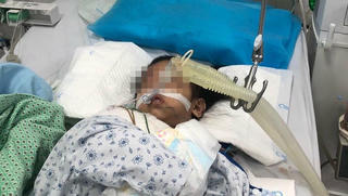 Lãnh đạo Hà Nội yêu cầu xử nghiêm vụ bé gái nghi bị người tình của mẹ đóng đinh vào đầu