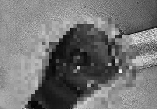 Anh trai 5 tuổi nghịch súng tự chế của bố, bắn trúng ngực em 4 tuổi