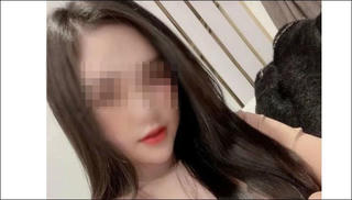 Cô gái tử vong sau 2 tháng hôn mê vì nâng mũi