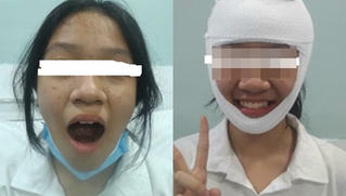 Ngáp to không ngậm được miệng, cần đưa ngay đến bệnh viện